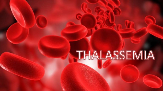 Thalassemia : Reasons, symptoms and Treatment