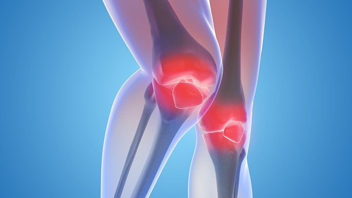 Why does arthritis pain occur? What to do with arthritis pain?