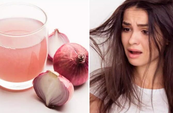 Onion solves 5 hair problems