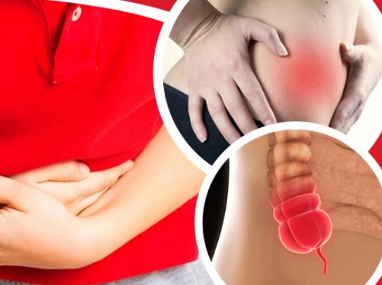 5 dangerous symptoms of appendicitis that should not be avoided