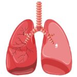 Tuberculosis Symptoms, Causes and Treatments