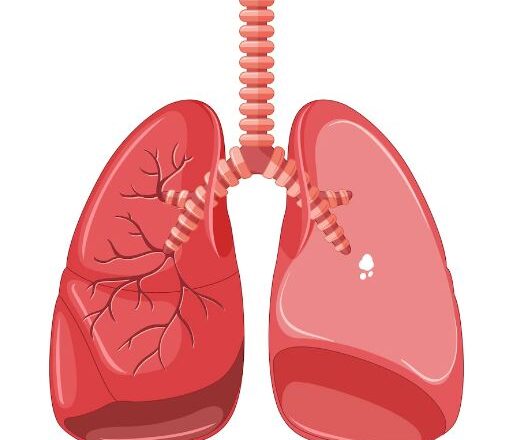Tuberculosis: Symptoms, Causes, and Treatments