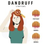 Herbs To Prevent Dandruff In Winter