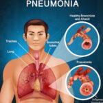 pneumonia home remedies