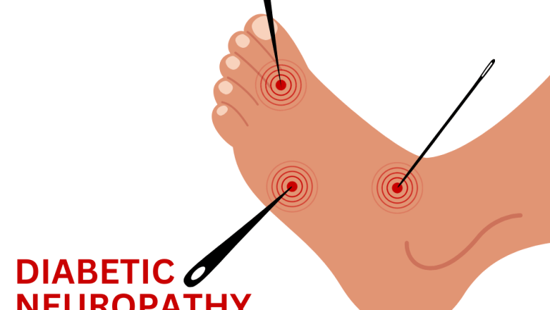 <strong>Understanding Diabetic Neuropathy: Nerve Damage Linked to Diabetes</strong>