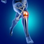 Knee Pain: Causes and Remedies